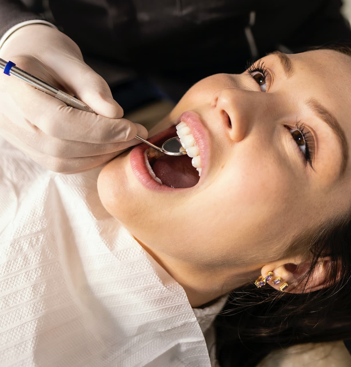 white filling dentist